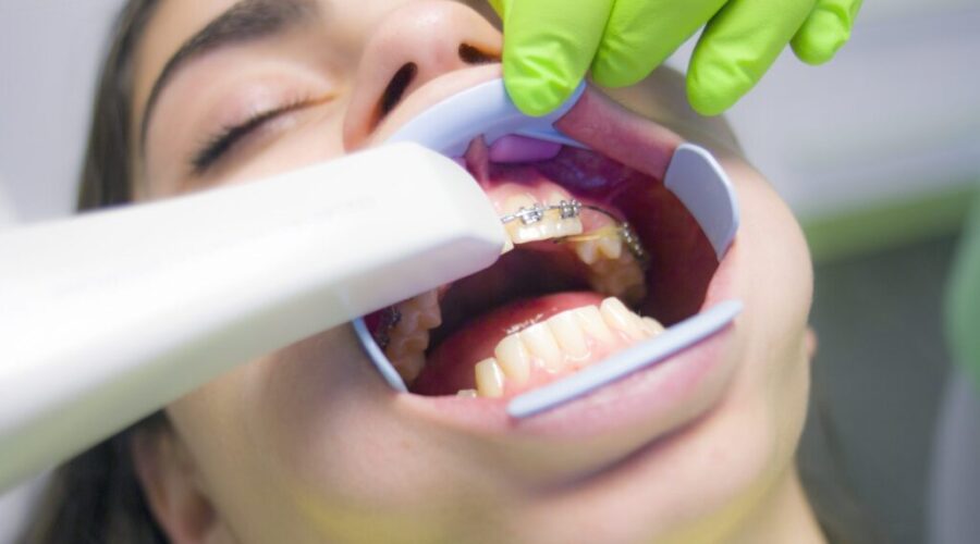 Some Details Out On Kids Federal Dental Benefit