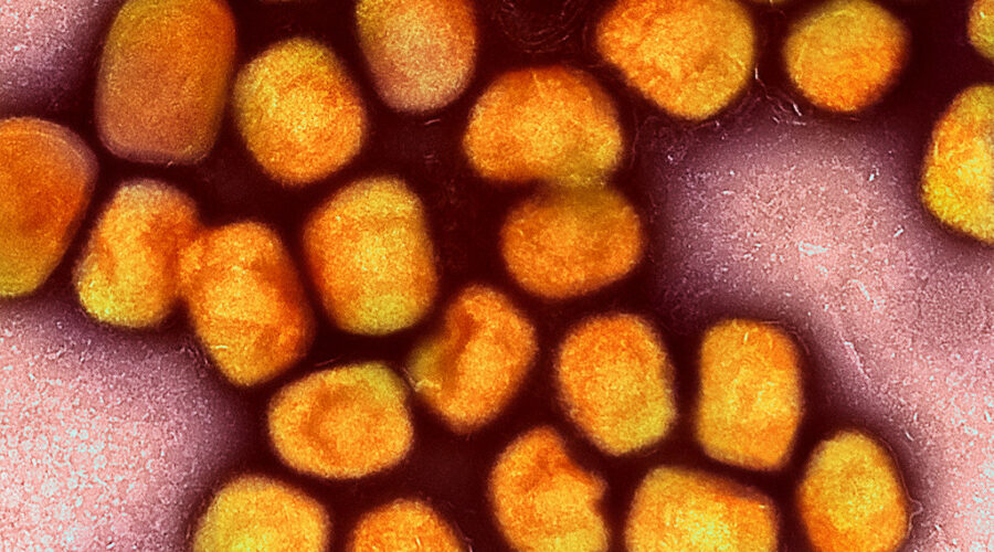 Mpox declared a global public health emergency for 2nd time