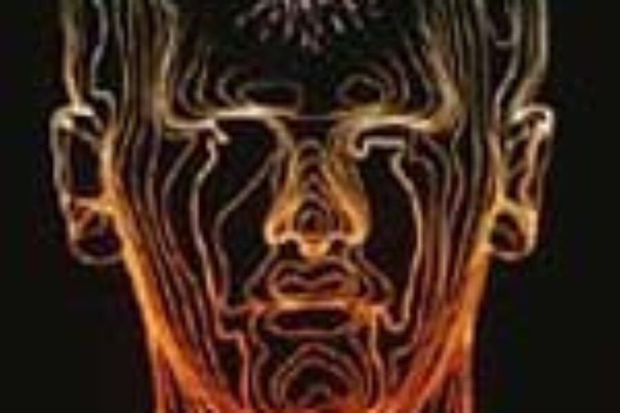 The Migraine that SEEMS like a Stroke!