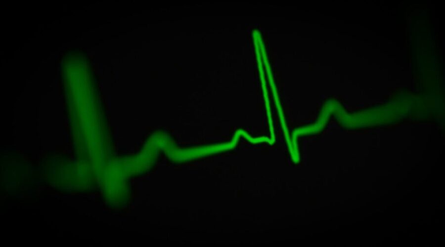 Steve Scharf Joins ‘The Morning Surge’ To Talk About Stroke Awareness